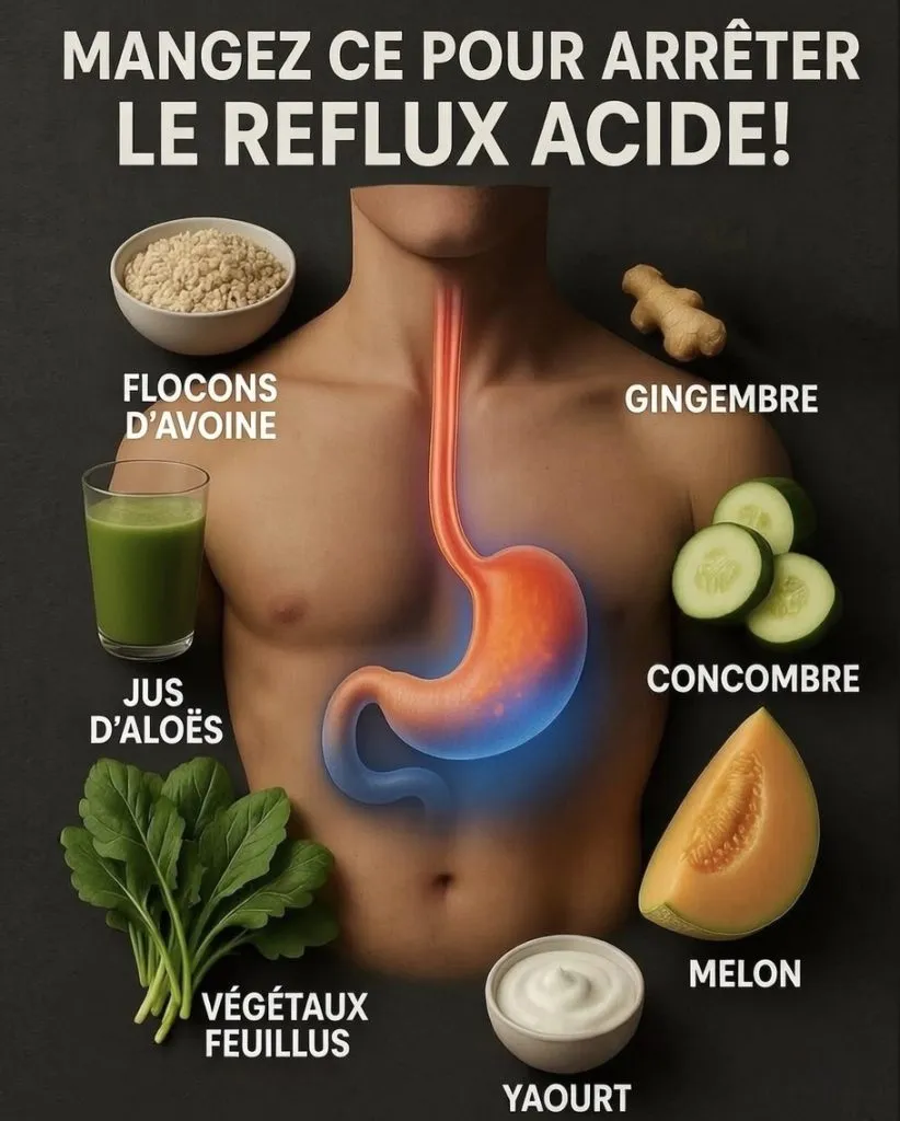reflux acide