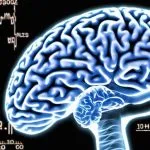 parkinson