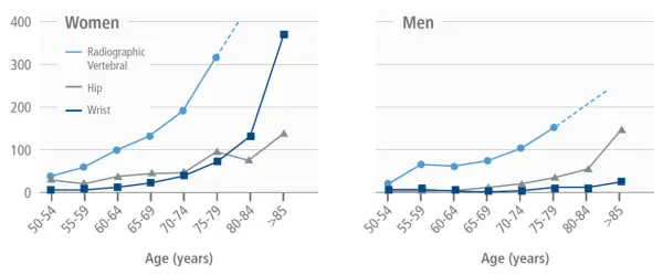 Incidence des fractures selon l'âge et le sexe