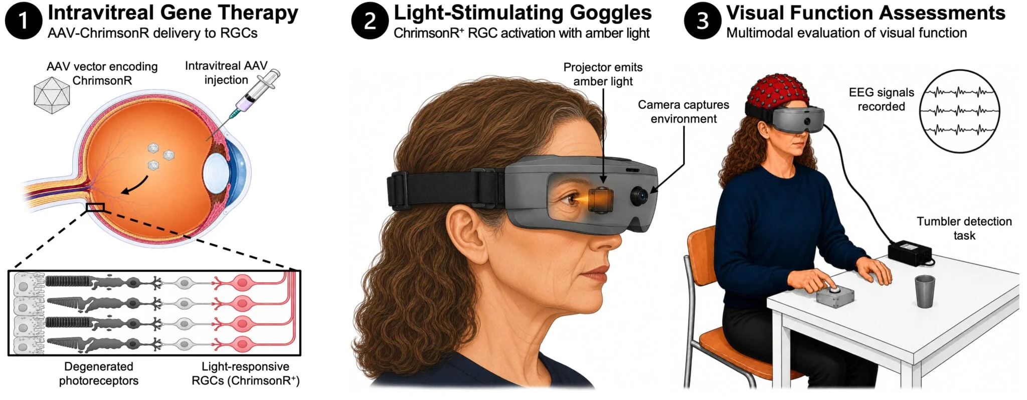 Illustration en trois volets : injection dans l'œil, lunettes de stimulation lumineuse et test visuel avec EEG.